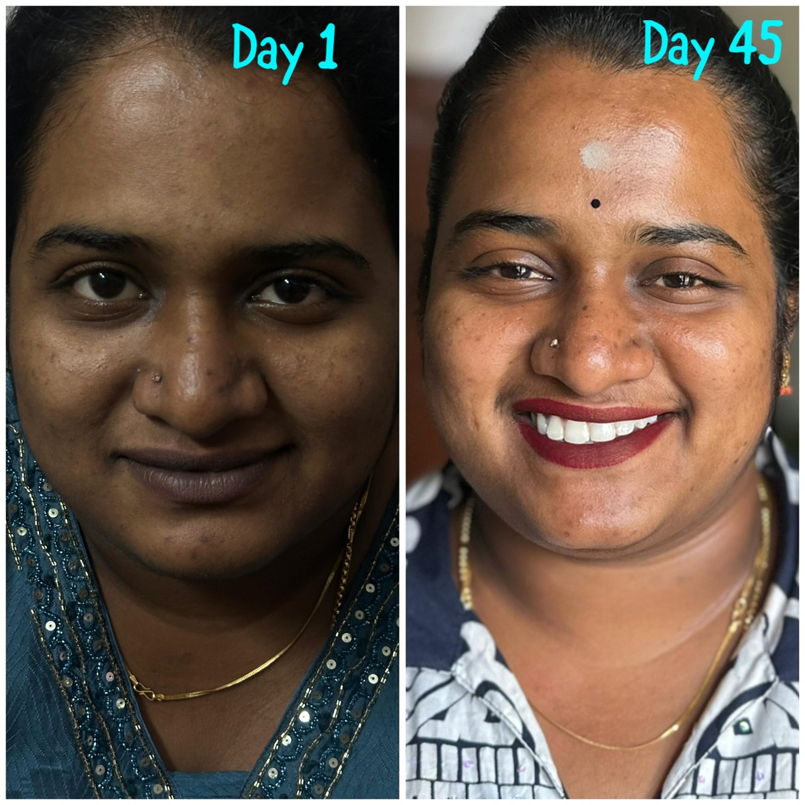 BHUVANA UNEVEN SKIN & DARK CIRCLES D1-D45